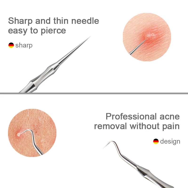 New German Acne Blackhead Removal Needles Pimples Blackhead Clip Tweezers Beauty Artifact Blemish Extractor Remover Needle Tool