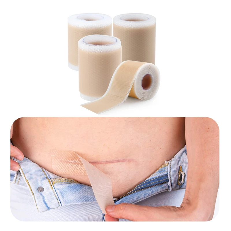 1pcs Silicone Scar Sheets,Scar Reducing Treatments for Surgical Scars,Burn,Tummy Tucks,Acne,C-Section,Wound Bandages