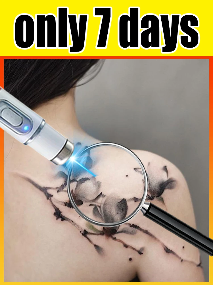 

Lᴀsᴇʀ Pʟᴀsᴍᴀ Pᴇɴ Tᴀᴛᴛᴏᴏ ʟᴀsᴇʀ ᴘᴏɪɴᴛᴇʀ ᴛʜɪʀᴅ ɢᴇɴᴇʀᴀᴛɪᴏɴ ʙʟᴜᴇ ʟɪɢʜᴛ