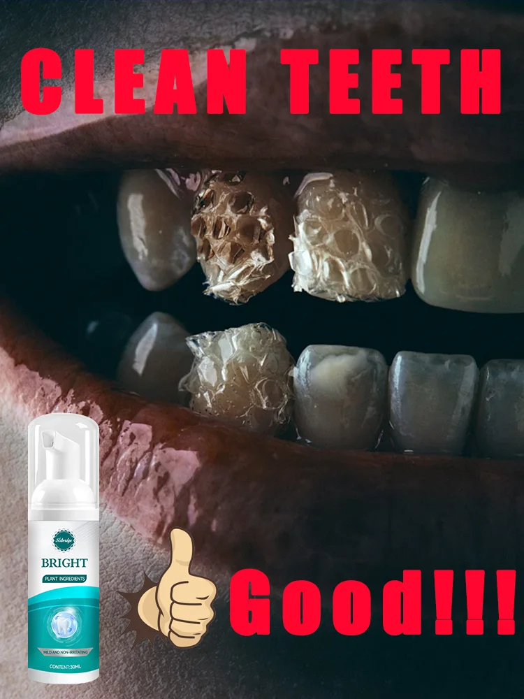 

[2025 NEW]Oral Foam,Teeth Cleaning Care Tools,Beauty,Efficient Dental Hygiene Products