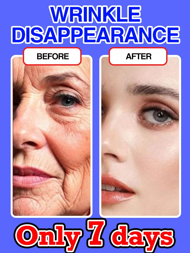 

Face-lift Slimming Cream Slimming Firming V-Shape Removal Masseter Muscle Double Chin Face Fat Burning Products