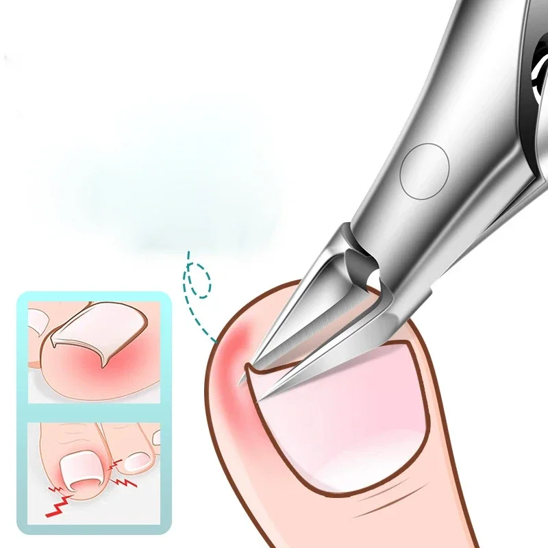Angled Nail Clippers for Ingrown Toenail Podiatry Correction Nippers Cuticle Cutters Cut Paronychia Pedicure Nail Cutters Tool