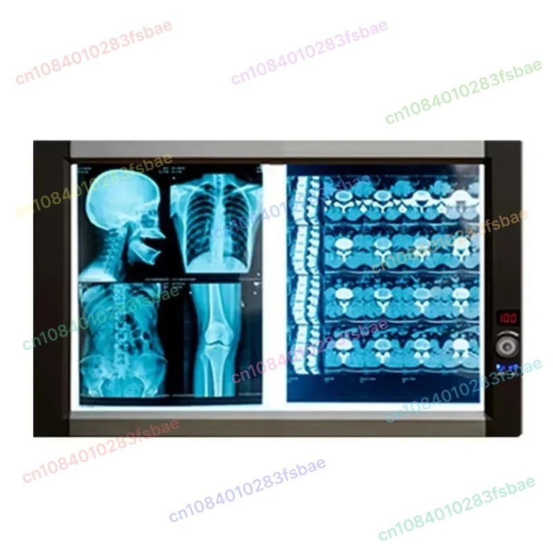 

Ultra slim LED 2 bank LED de ntal negatoscope medical X ray film viewer with CE with ISO13485