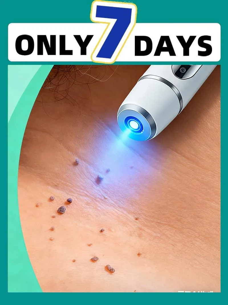 

3ND Gᵉⁿᵉʳᵃᵗⁱᵒⁿ Uᵖᵍʳᵃᵈᵉᵈ wᵃʳᵗ ⸴ ʳᵉpᵃⁱʳ wᵃʳᵗˢ ʳᵒoᵗ ⸴ ᑫᵘⁱᶜᵏˡʸ Z26