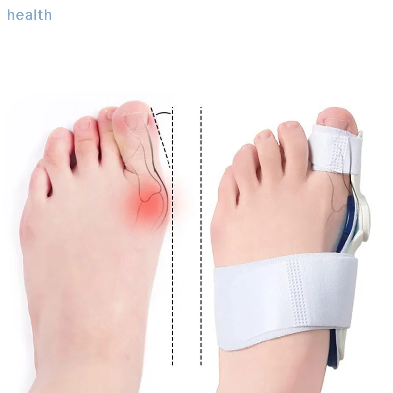[YA] جبيرة الورم الجل لأصابع القدم الكبيرة، مصحح لتخفيف آلام القدم، أروح القدم