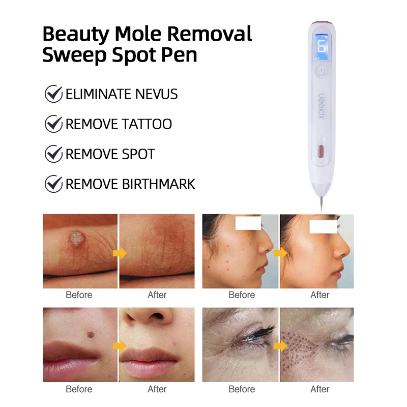 Foreverlily Moles Removal Pen Xpreen LCD Display Laser Plasma Pen Warts Remover Spot Tattoo Cleaner Skin Tag Removing Machine EU