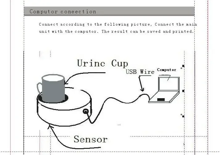SY-B169A Uroflowmetry Equipment urine measurement   hine Urine Flow Meter uroflowmeter
