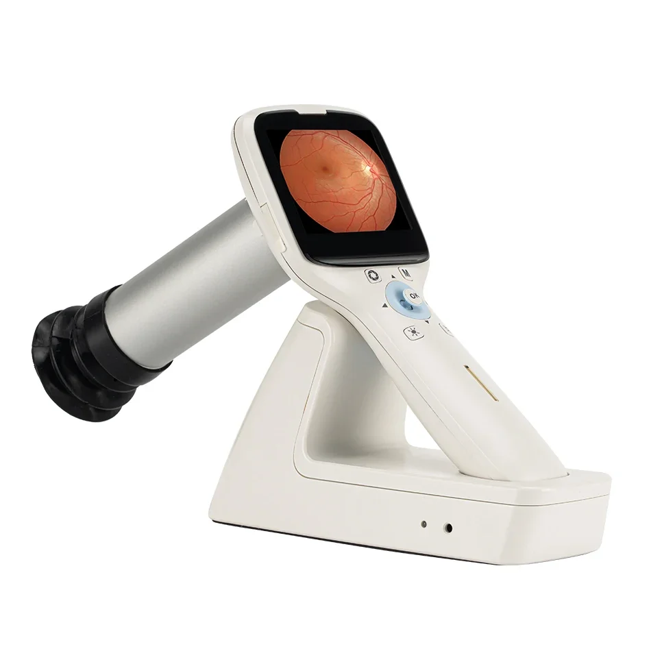 Digital Eye Fundus Camera for Retinal Imaging