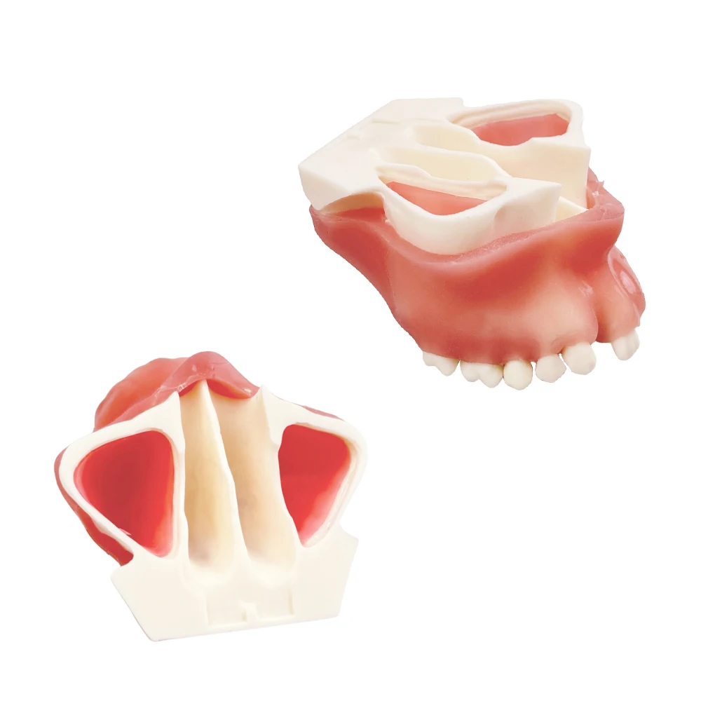 1 pz Impianto a bocca piena del seno massilare con modello di denti mancanti Modello di pratica didattica per studenti