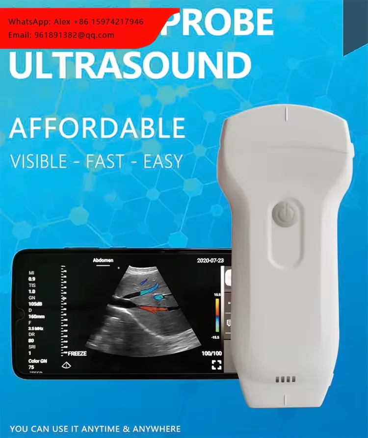 Newest 5G Wireless Dual Heads With Convex Linear And Cardiac Probe Color Doppler 3 In 1 Ultrasound System