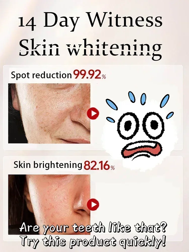 Whitening and freckle removal cream removes dark spots, chloasma, age spots, sun spots, skin whitening and freckle removal cream