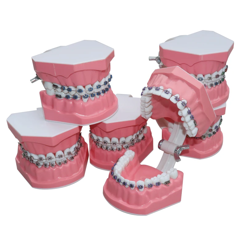 32 Teeth Dental Preparation Model With Orthodontic Braces, Simulated Jaw Typodont For Dental Teaching & Training