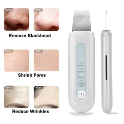 Ultrasonic skin scraper to remove blackheads, acne, dirt, pores, cleansing ems beauty instrument micro-current skin scraper