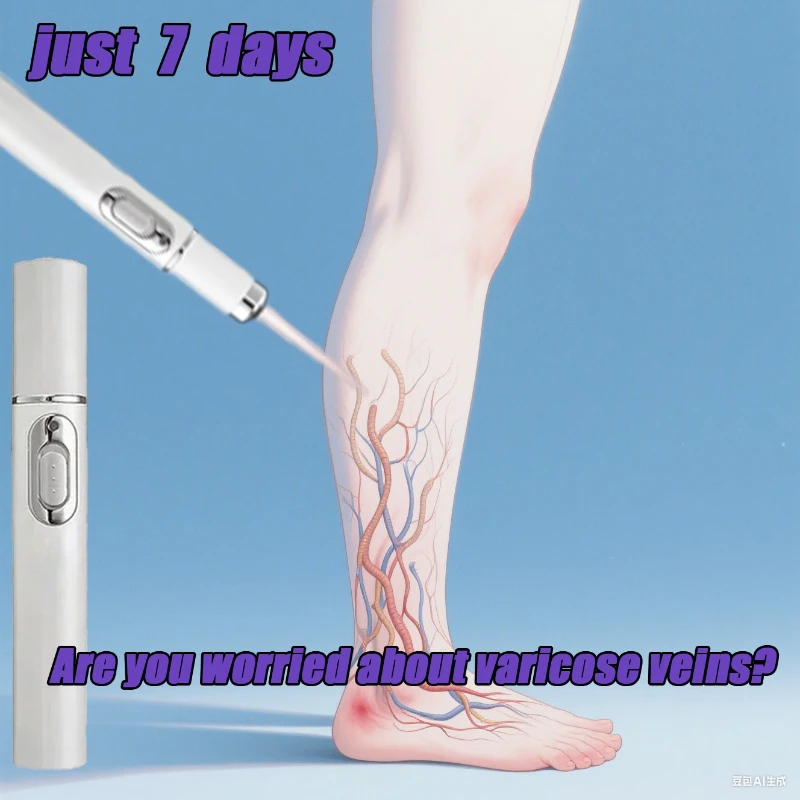 

Laser Pen Lampshade Tool Varicose Veins Effective Relief of Dilated Vasculitis in The Legs Phlebitis Improved Blood Circulation