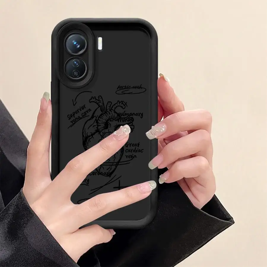 Etui na Redmi Note 10 11 12 Pro 11s 13 14 Pro Plus 12s Miękka obudowa z wzorem kreskówkowego serca