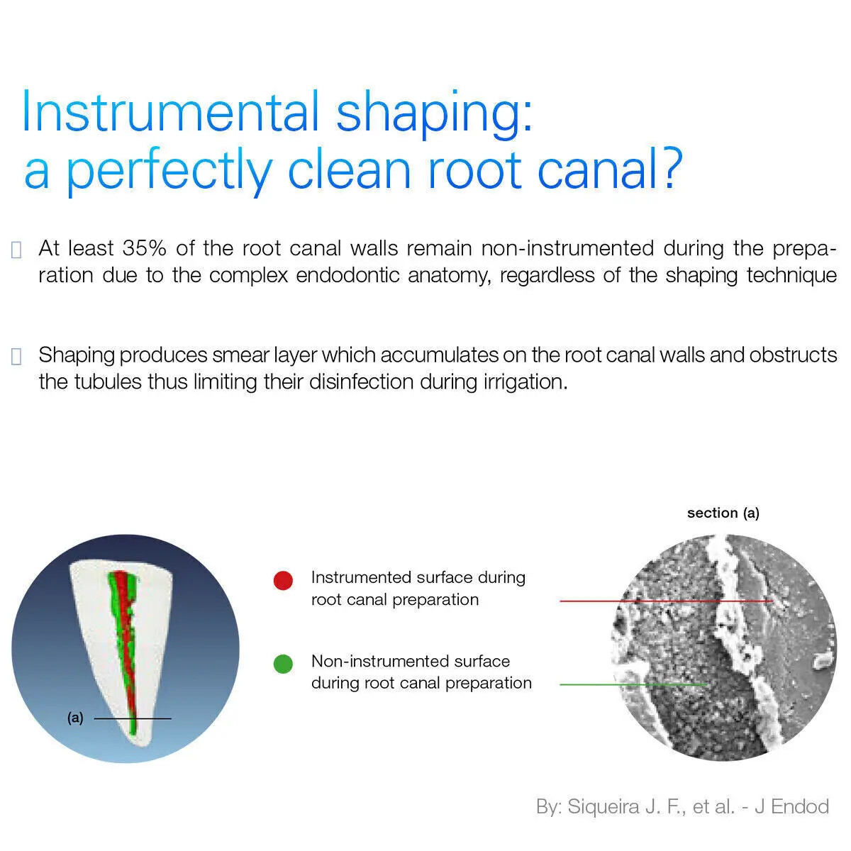3 نصائح C20/02 G20/02 B20/02 لقبضة الري منشط إندو الترا #5