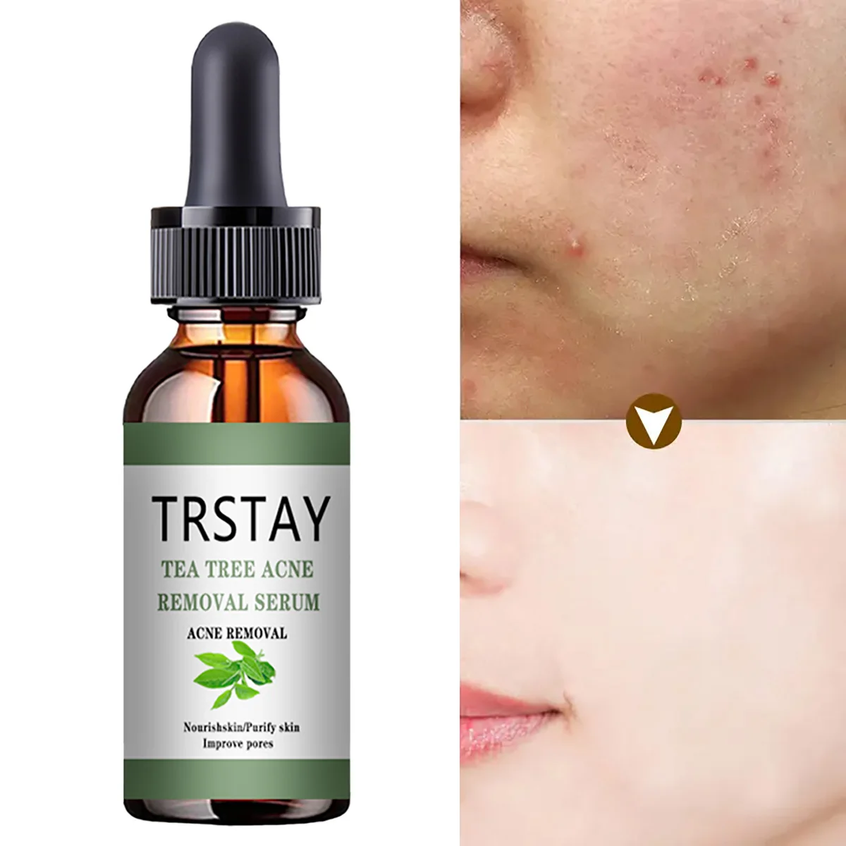 

Acne Treatment Face Serum Tea Tree Oil Essence Moisturizing Shrink Pores Acne Facial Serum Korean Skin Care Products