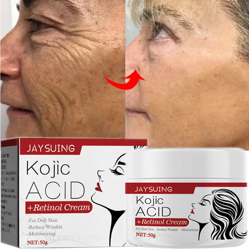 

Retinol Wrinkle Remover Face Cream Anti-Aging Fade Fine Lines Kojic Acid Whitening Freckles Remove Melasma Dark Spots Skin Care