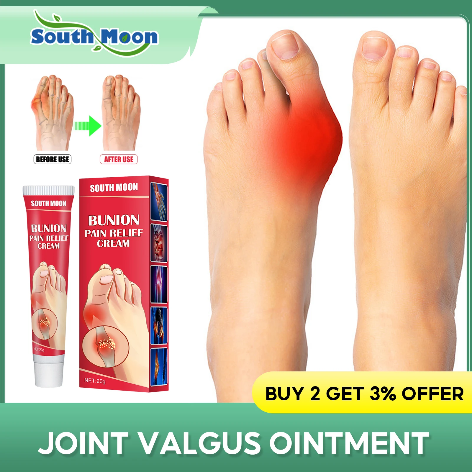 

Gout Pain Relief Ointment Cure Bunion Hallux Knee Valgus Corrector Reduce Uric Acid Swelling Pain Relief Thumb Corrector Cream