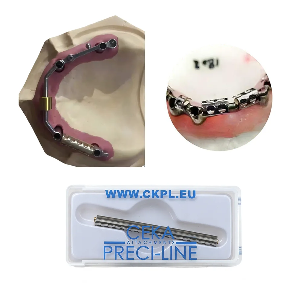 Dental Implant Bar Attachment Clip U Shape Fixing Metal Holder Abutment Analog Clamping Tool Dental Lab Technician Materials