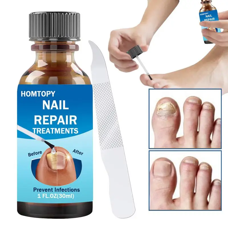 Solution réparatrice pour ongles, renforcement des ongles, soin des mains et des pieds, soucieux pour les doigts et les orteils endommagés, décolorés et fissurés 64.