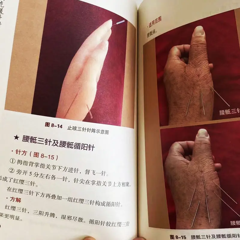 L'acupuncture manuelle des voies respiratoires de Chen est un livre TCM théorique qui produit les voies respiratoires basé sur l'acupuncture manuelle traditionnelle