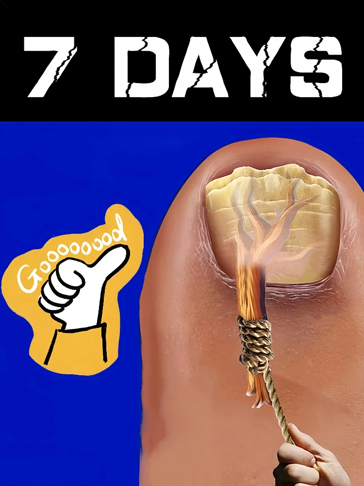 Ferramentas limpas de escova de unhas, aspiradores de pó de plástico, diga adeus às problemas de unhas Conjunto de combinação de refeições Ferramenta de pacote de manicure