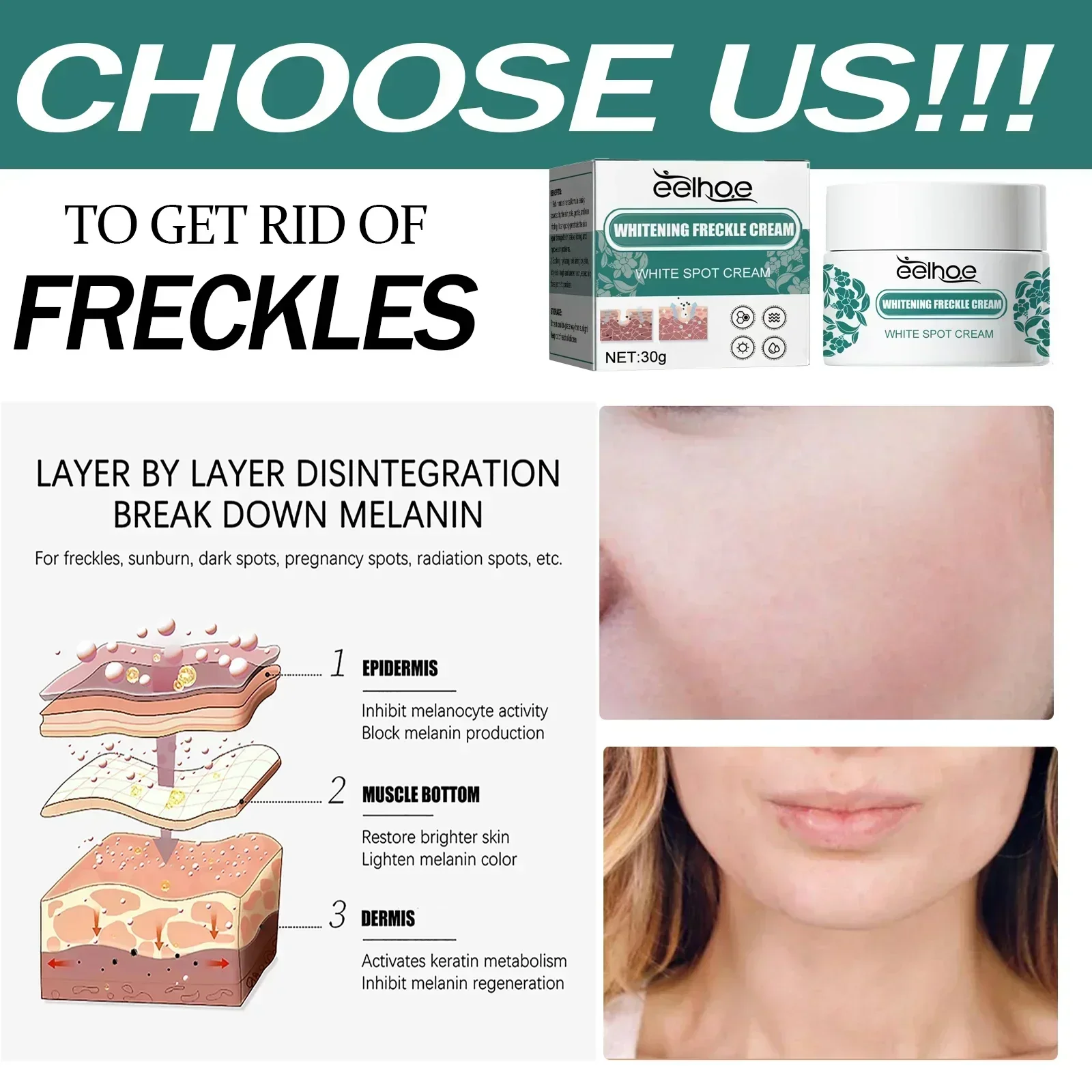 Effective Freckle Cream Fast Brighten Face Remove Melasma Dark Spot Fade Melanin Whiten Anti-pigmentation Improve Dullness