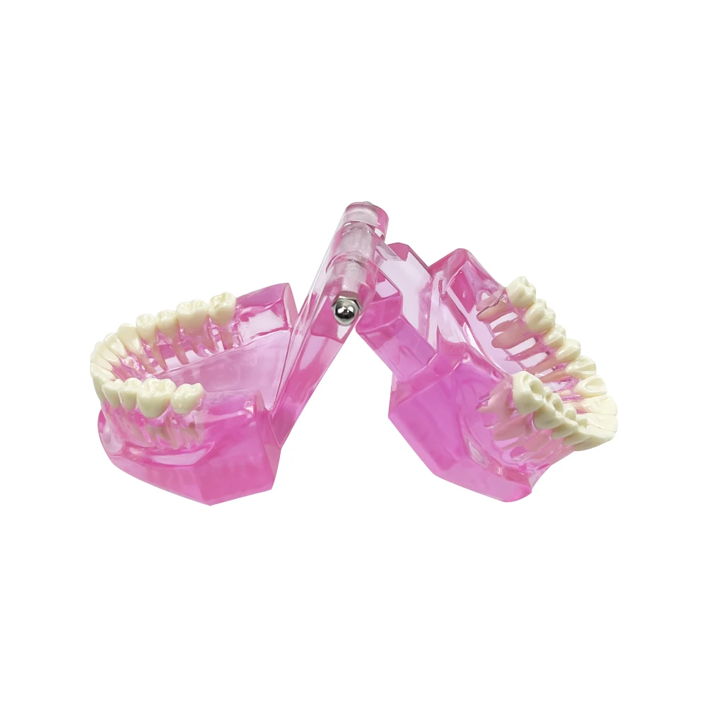 Normal Dental Model Pink Transparent Standard Teeth Jaw Model Typodont For Dentist Student Teaching Study Demonstration Tools