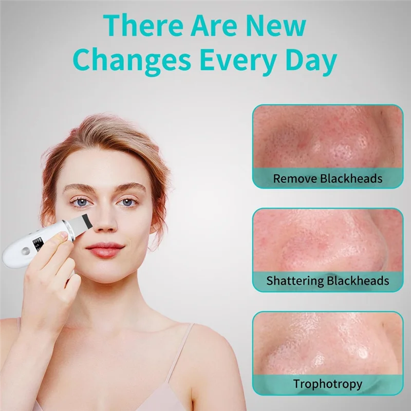 Espátula facial para purificador de pele m04k, ferramenta de remoção de cravo, doca de carregamento rápido, função de limpeza profunda para extração de poros