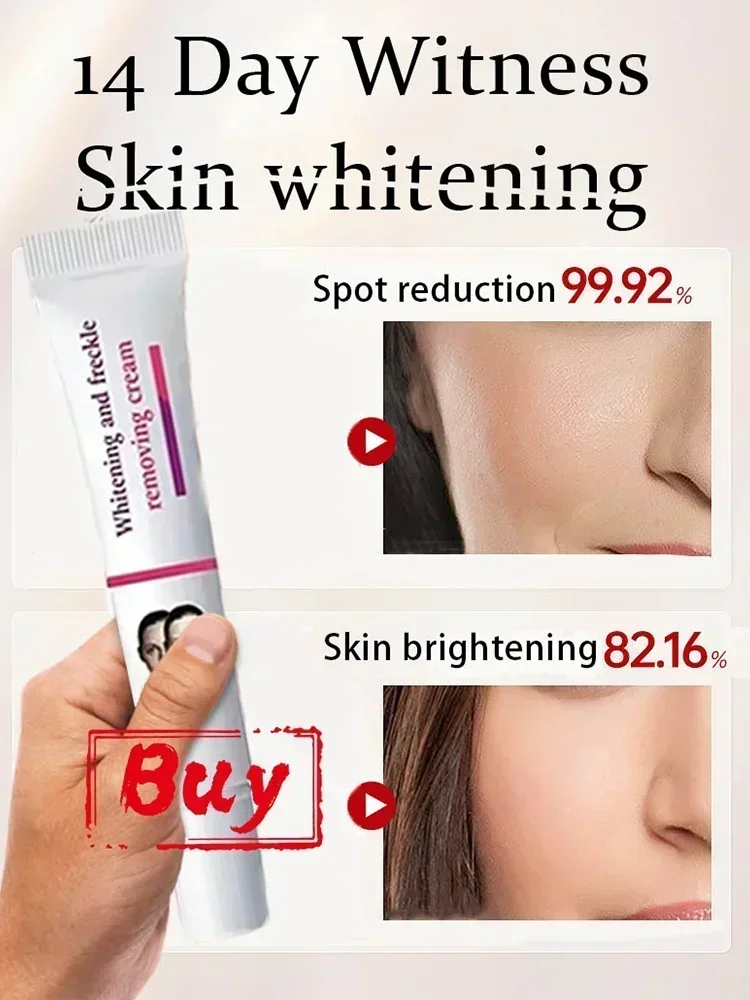 Whitening and freckle removal cream removes dark spots, chloasma, age spots, sun spots, skin whitening and freckle removal cream