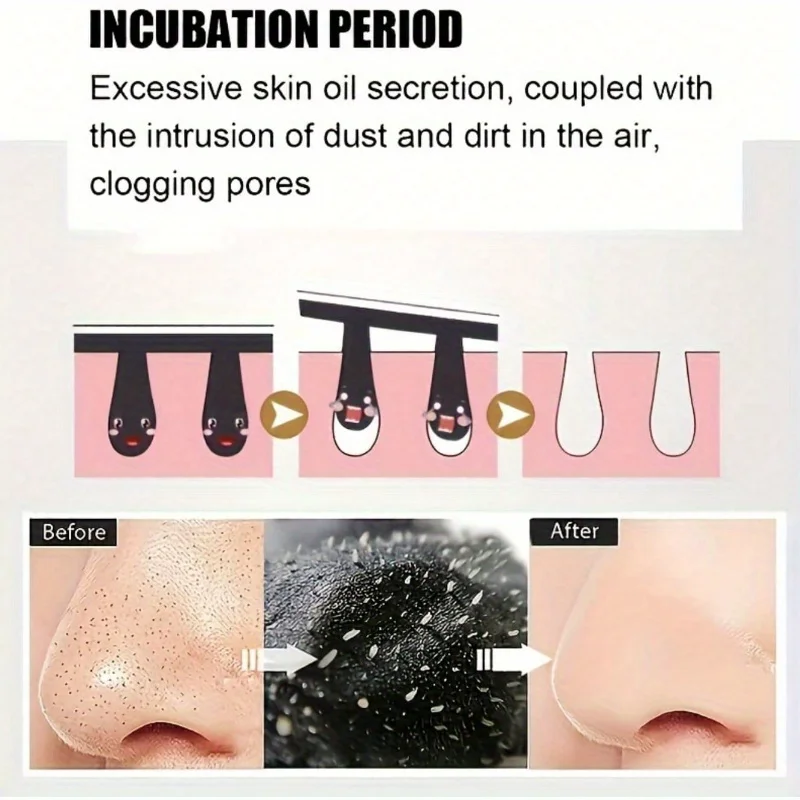 Alcohol-Free Pore Cleansing Nose Strips Deep Cleansing Shrink Pores, Blackhead Nose Strips For Deep Cleansing