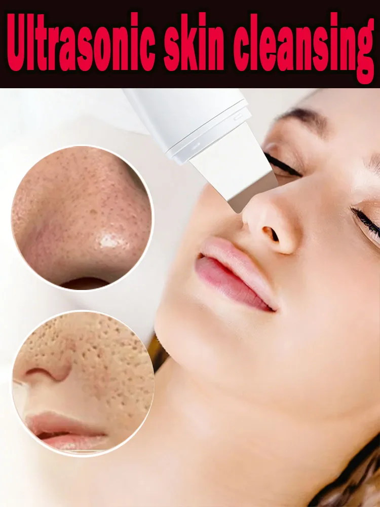 exfoliating-blackhead-removermultifunctionalultrasonic-facial-cleansing-device-unisexfree-shipping-special-offer