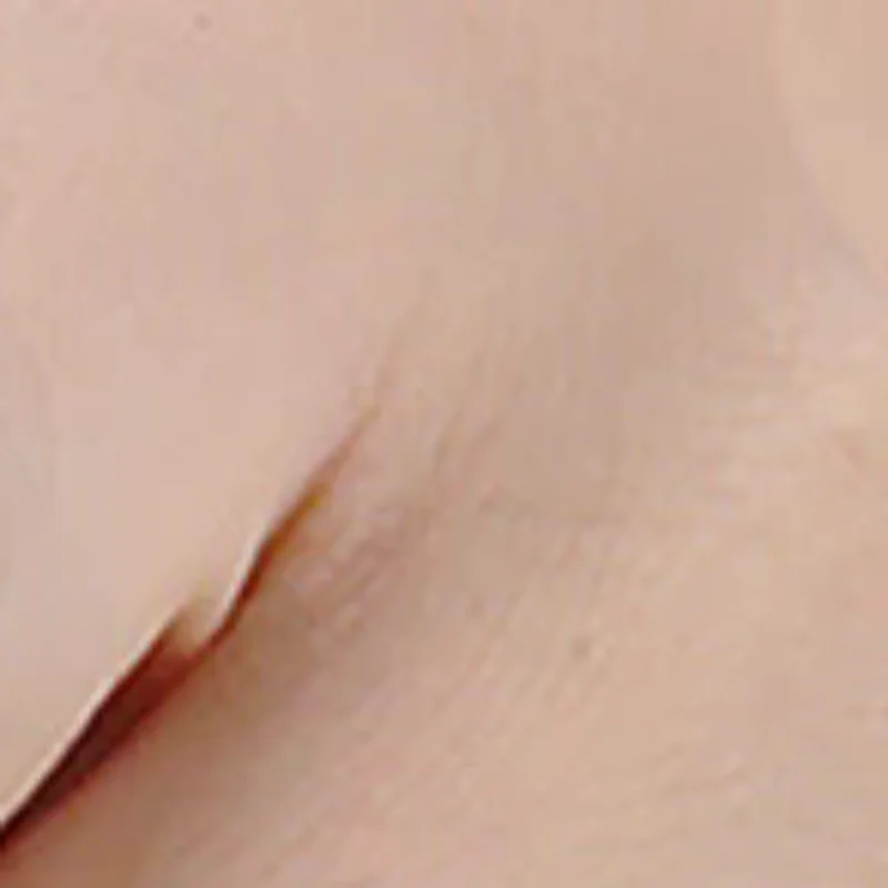 

2/3/5 Strip Wound Closure Tape Adhesive Sterile Medical Bandage Strip Skin Repair First Aid Surgical Breathable Tape 10CM