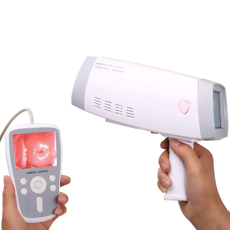 The most cost-effective HKN-2000 handheld digital gynecological video colposcopy for gynecology