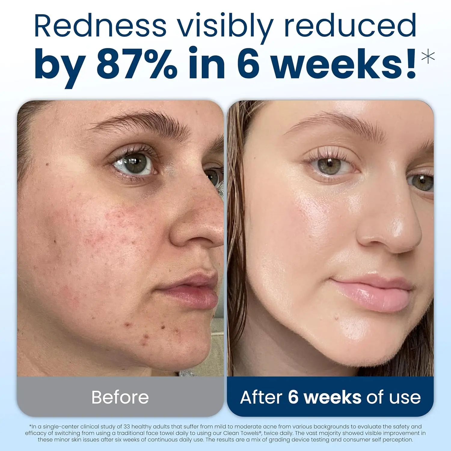 Disposable Face Towels XL, 100% USDA Biobased, Eczema Accepted, Ultra Soft Makeup Remover Wipes, 200 Count Total