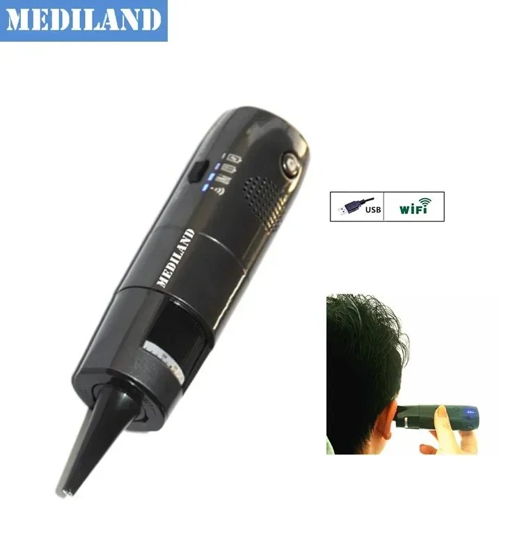 ML-402O Wifi Otoscope for  IOS/Android/WIndows HD video household otoscope wireless Endoscope to check ear and nose