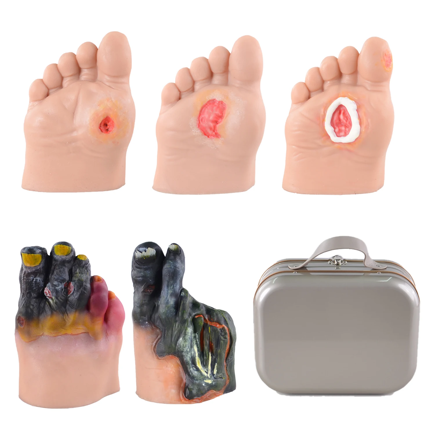 Diatbetic Foot Care Simulators of 5 Stages, Diabetic Foot Ulcer Model Set