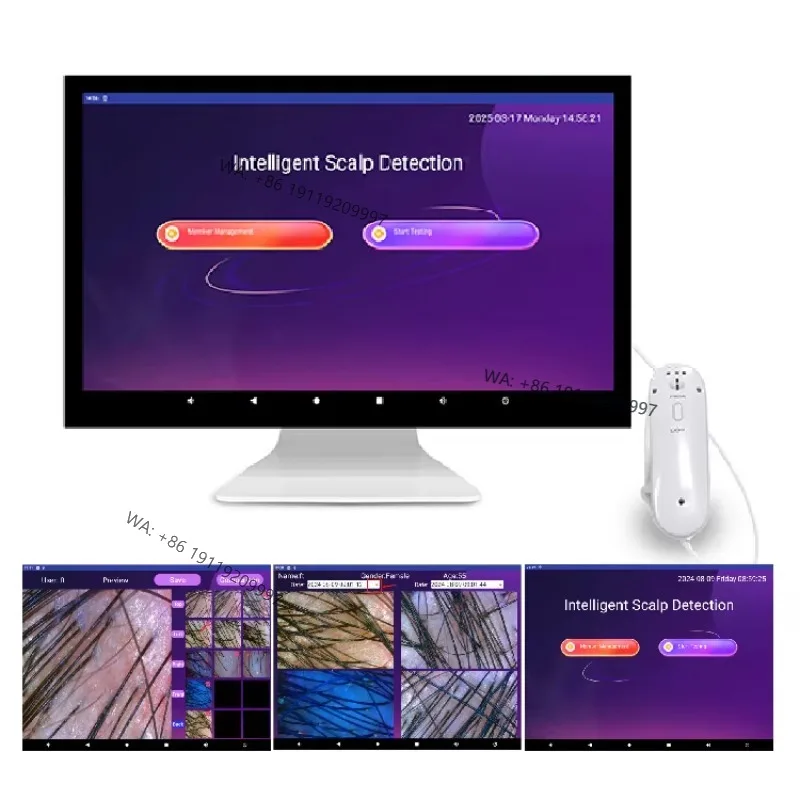 

2026 Hair Follicle Skin Detector Head Scalp Analyzer Machine Hair Analyzer Scalp Detector Scalp Machine