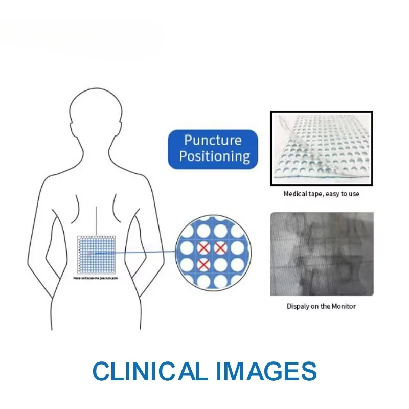 

Good priceMedical X-ray CT Grid Detectable Locator Radiopaque Positioning Tape Radio Opaque Grid manufacturer