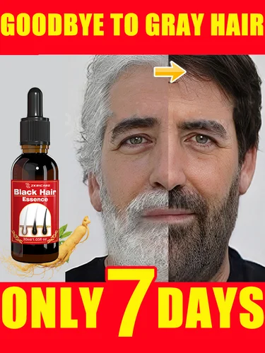 [Convierte el cabello en negro en 7 días] Esencia natural para cabello blanco a negro, extracto de ginseng, previene las canas, fortalece el cabello y repara los folículos pilosos.