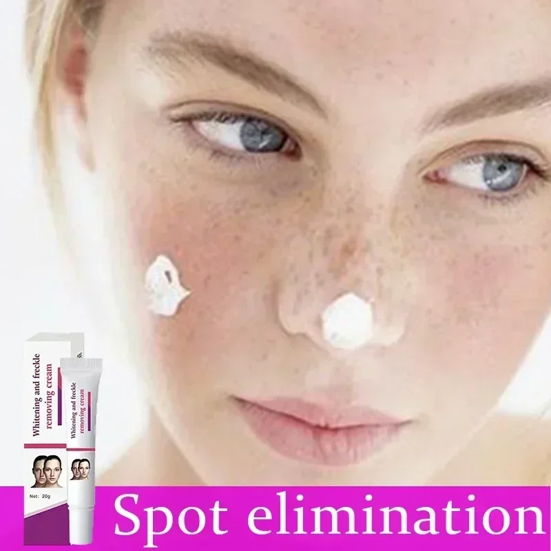 

Skin Remove Dark Spots Whitening Freckle Cream Effective Remove Melasma Melanin Moisturize Brighten Smooth Face Cream Skin Care