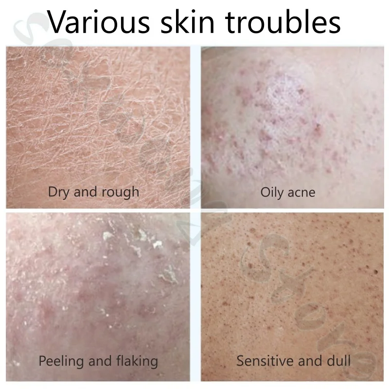 كريم الوجه قبل المكياج، مرطب ويدوم طويلاً، ليس من السهل الالتصاق على البودرة، يناسب بشكل طبيعي وتحسين البشرة الجافة 30 جرامًا