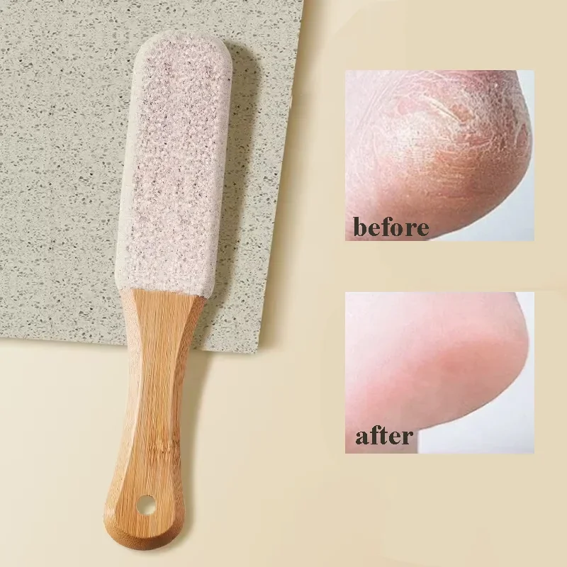 Callus Remover Foot Scrubber Colossal Foot File Foot Care and Foot Exfoliator Foot Rasp Pedicure Tools Pumice Stone for Feet