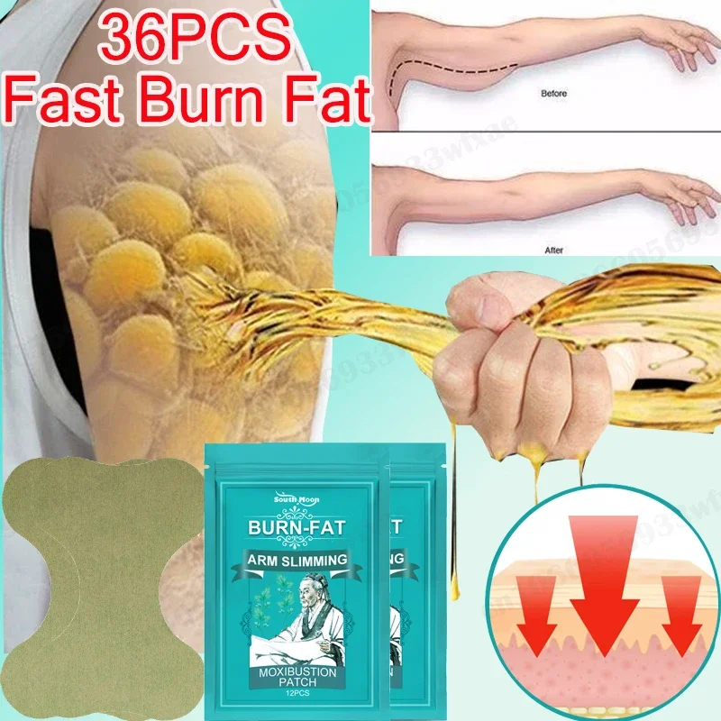 Thin Arm Moxibustion Paste Slim Down Stickers Slimming Products To Burn Fat Chinese Herbal Plaster Lose Weight Patch Slim New