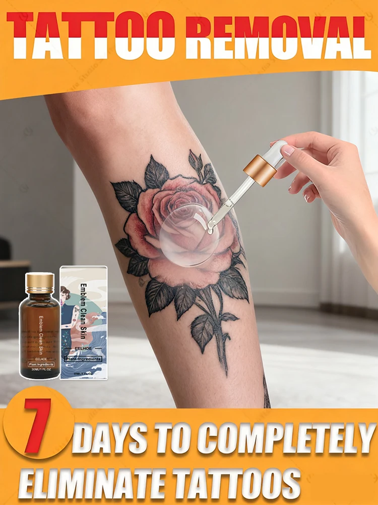 

Tattoo Removal Solution: Say Goodbye to Your Tattoo in 7 Days