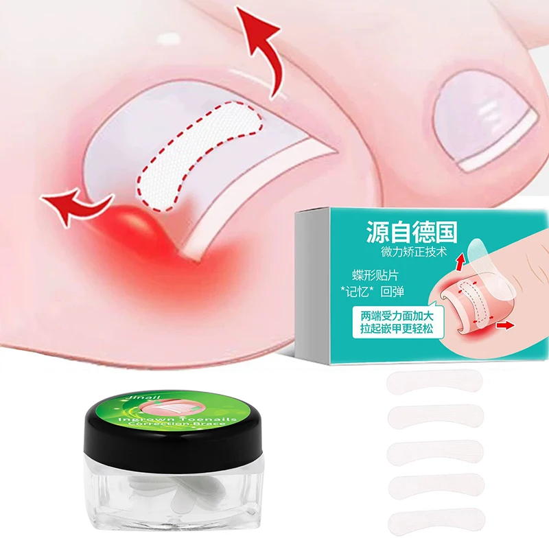 10Pcs Ingrown Toenail Correction Tool Straightening Clip Brace Ingrown Toe Nail Treatment Elastic Patch Sticker Pedicure Tool