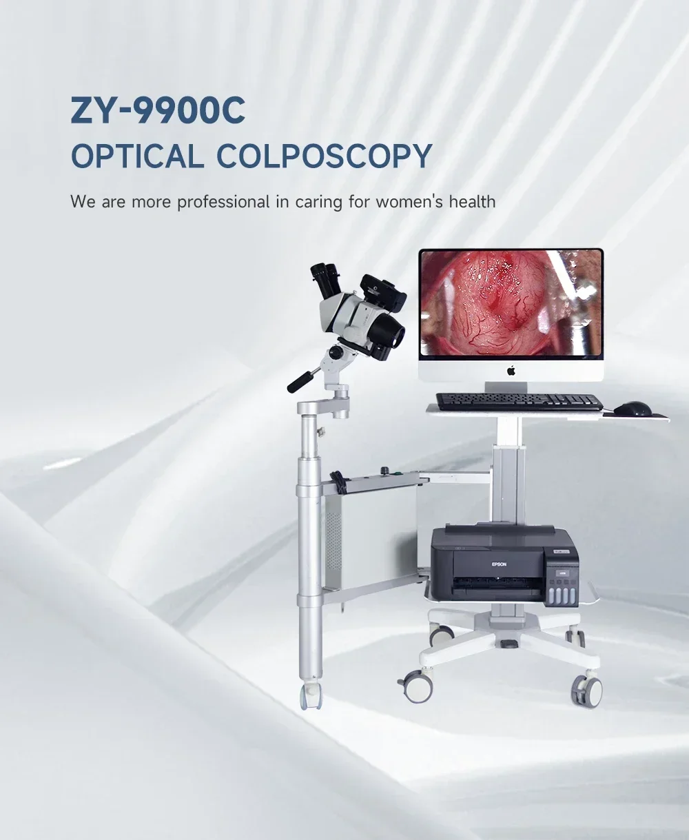 رائجة البيع عالية بكسل نطاق كولبو البصري لايكا عدسة بصرية ZY-9900C لفحص المهبل