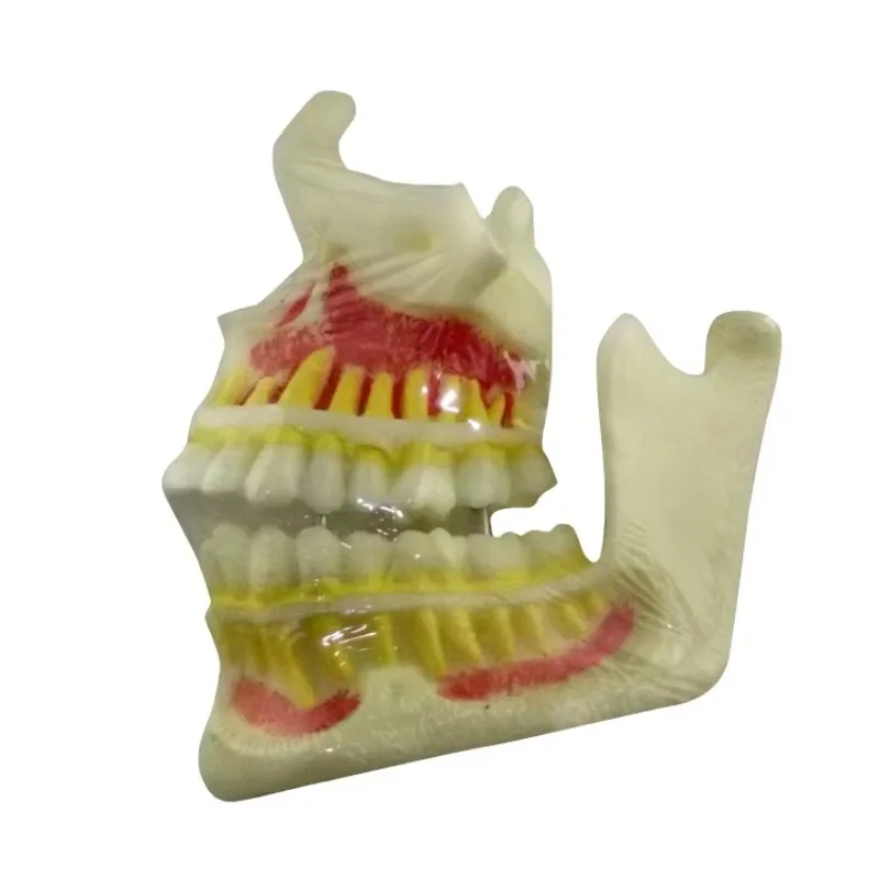نموذج تقويم الأسنان من YTYIN للتدريس، نماذج تعليمية للفك العلوي والفك السفلي #1