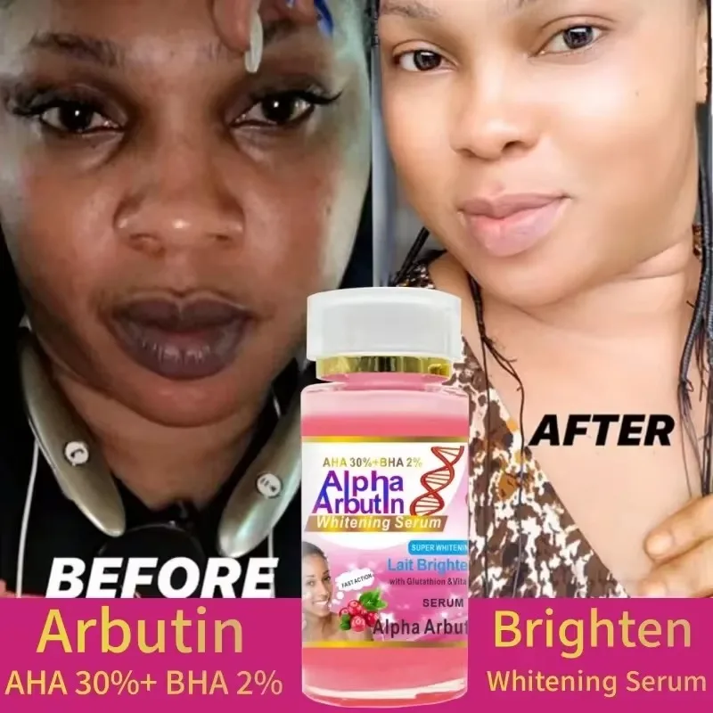 Alpha Arbutin Serum AHA 30%+ BHA 2%  Keeps Face Smooth Brightening Moisturizing Improving Dullness Dark Skin Beauty Care Cream